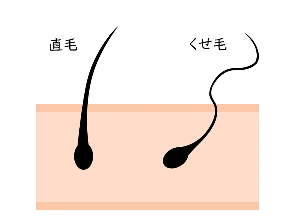 直毛とくせ毛の違い