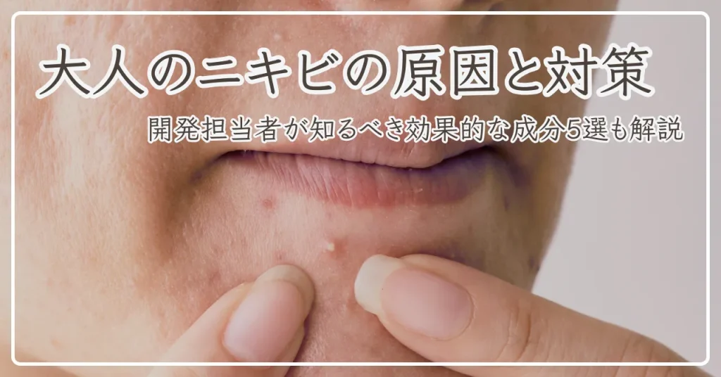 大人のニキビの原因と対策｜開発担当者が知るべき効果的な成分5選も解説