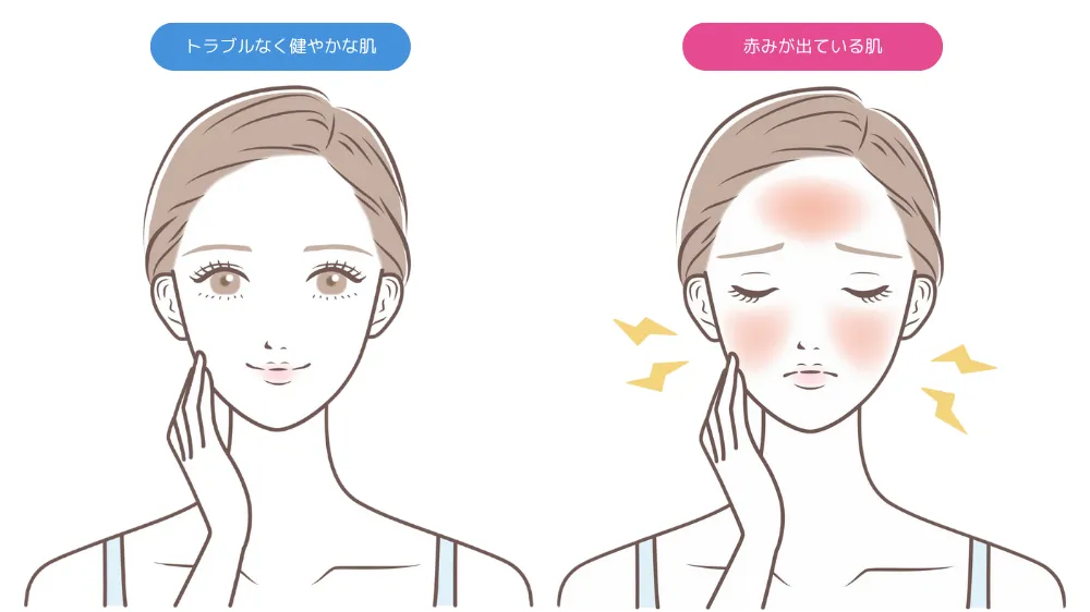 鎮静効果のイメージを伝える図