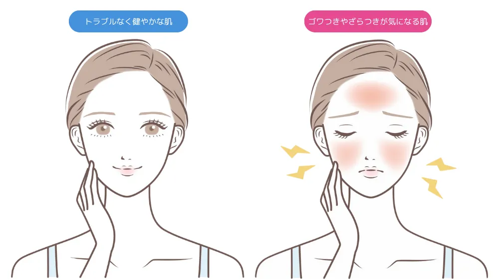 セラミドがもつ肌質改善効果