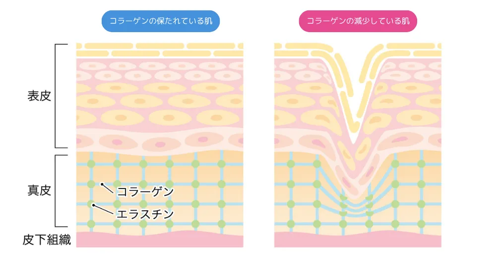 コラーゲンの働きを説明する図